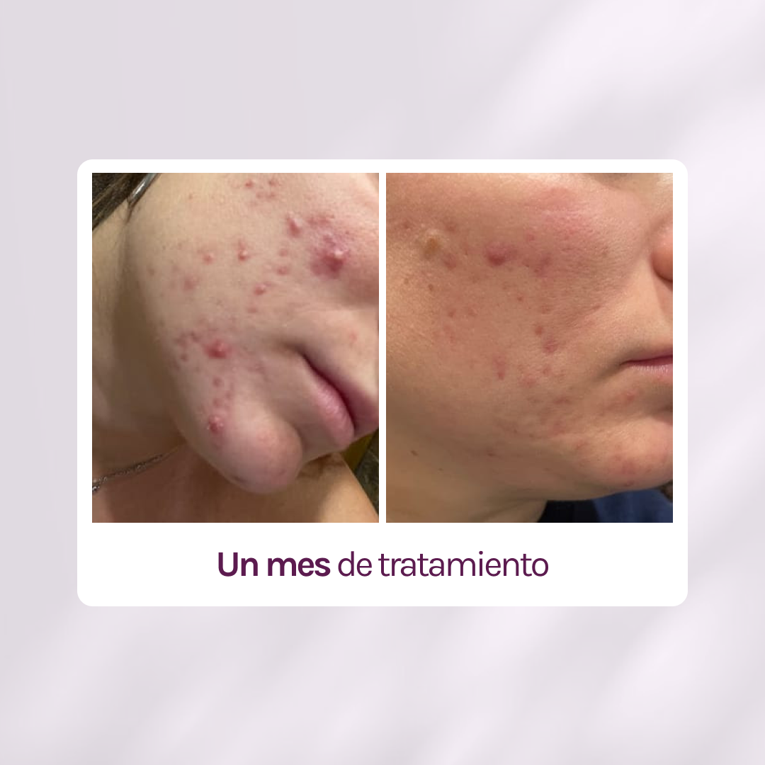 A CONTROL + CORTIZEN - Equilibrio hormonal desde el cerebro, los ovarios, la piel y el metabolismo.