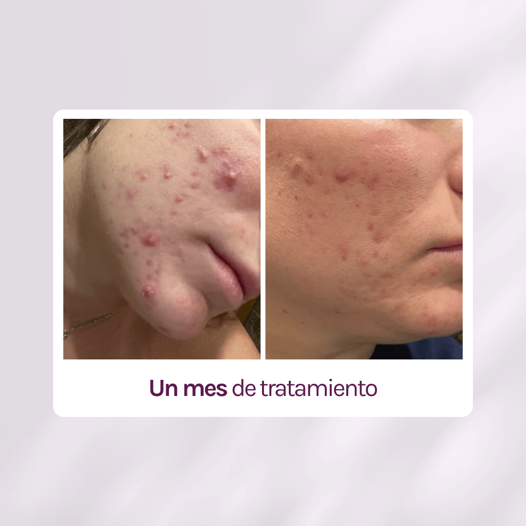 A CONTROL + CORTIZEN - Equilibrio hormonal desde el cerebro, los ovarios, la piel y el metabolismo.