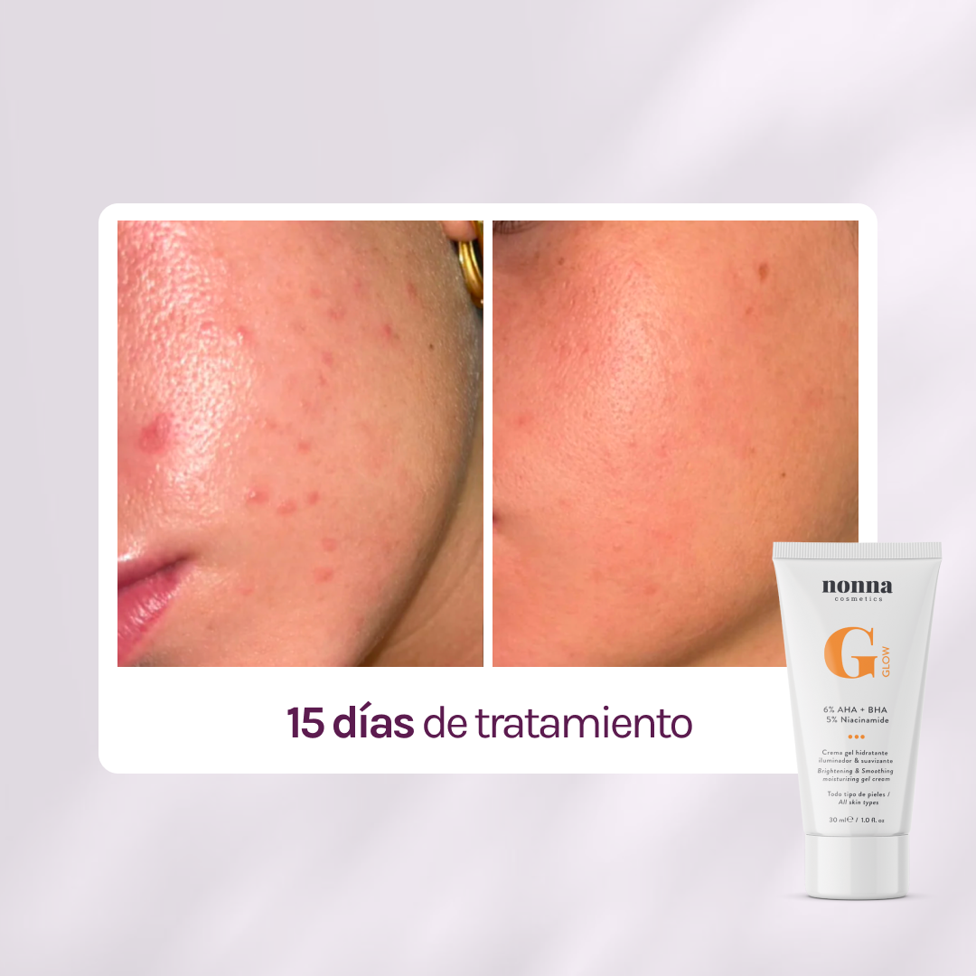 GGLOW Exfoliante - 5% Ácido Glicólico & Niacinamida