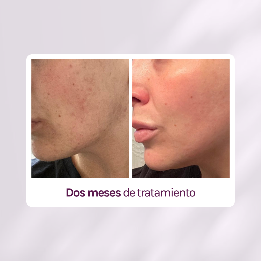 RUTINA AM - PIEL CANSADA + HIDRATACIÓN