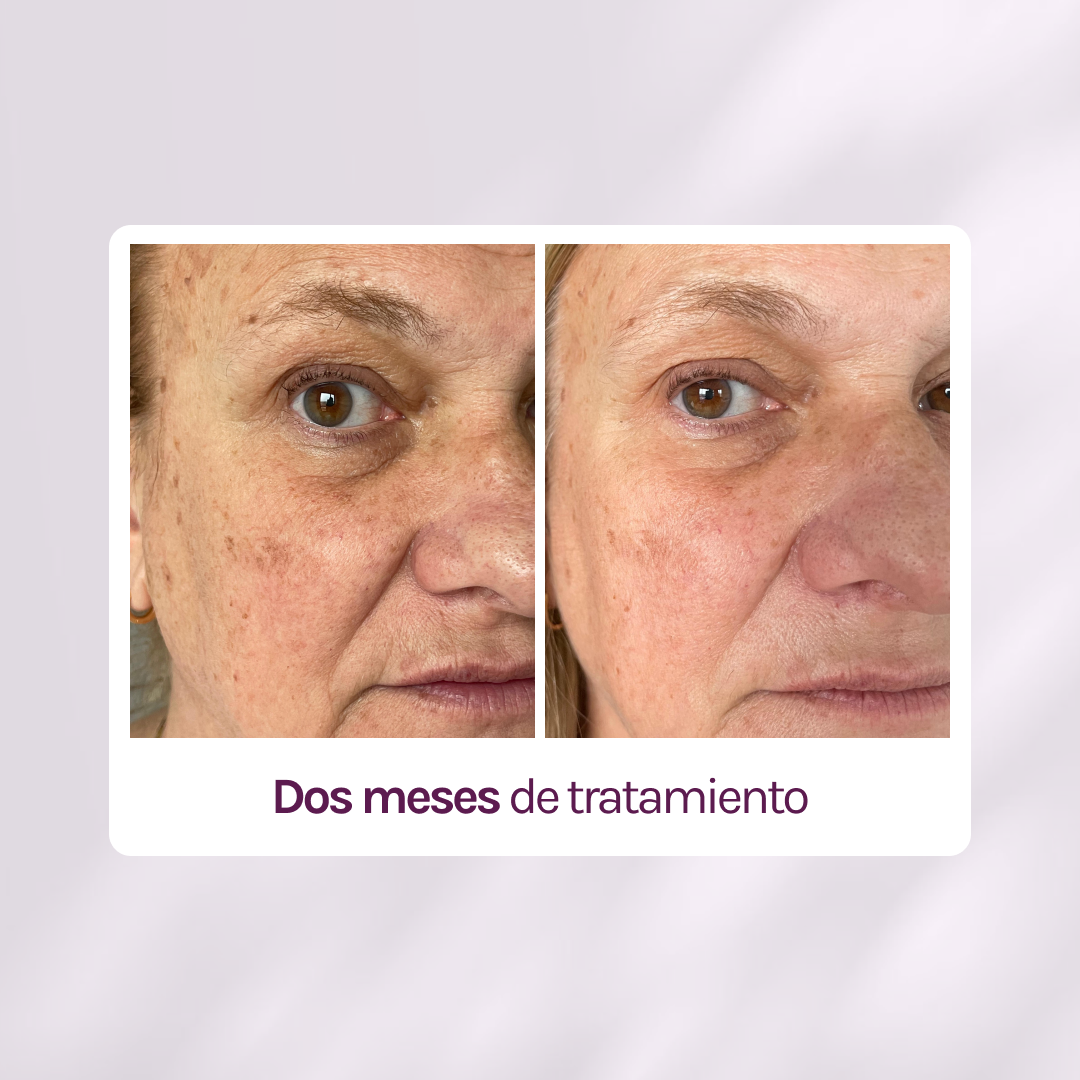 RUTINA PM ANTIAGE - ARRUGAS + FIRMEZA