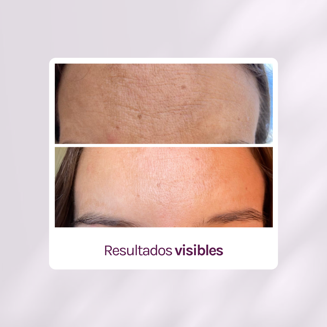 SUPER RUTINA - RUTINA AM&PM + CONTORNO DE OJOS