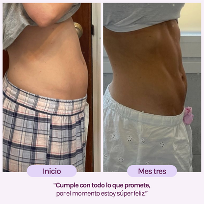 A CONTROL - ACNÉ HORMONAL &amp; RESISTENCIA A LA INSULINA