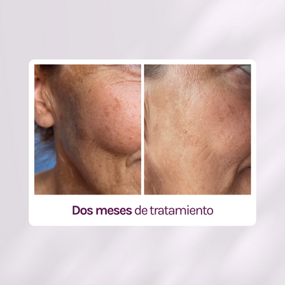 RUTINA AM&amp;PM - GRANITOS + MARCAS + POROS + MANCHAS + ARRUGAS