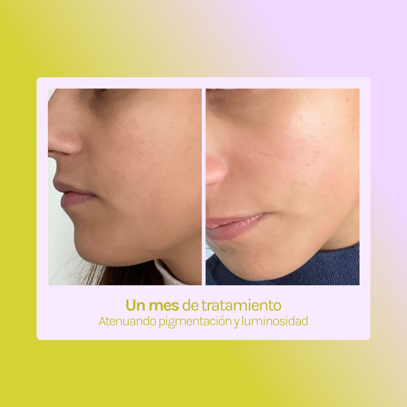 A.O.X Booster Antioxidante con vitamina C
