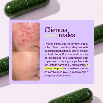 A CONTROL - ACNÉ HORMONAL &amp; RESISTENCIA A LA INSULINA