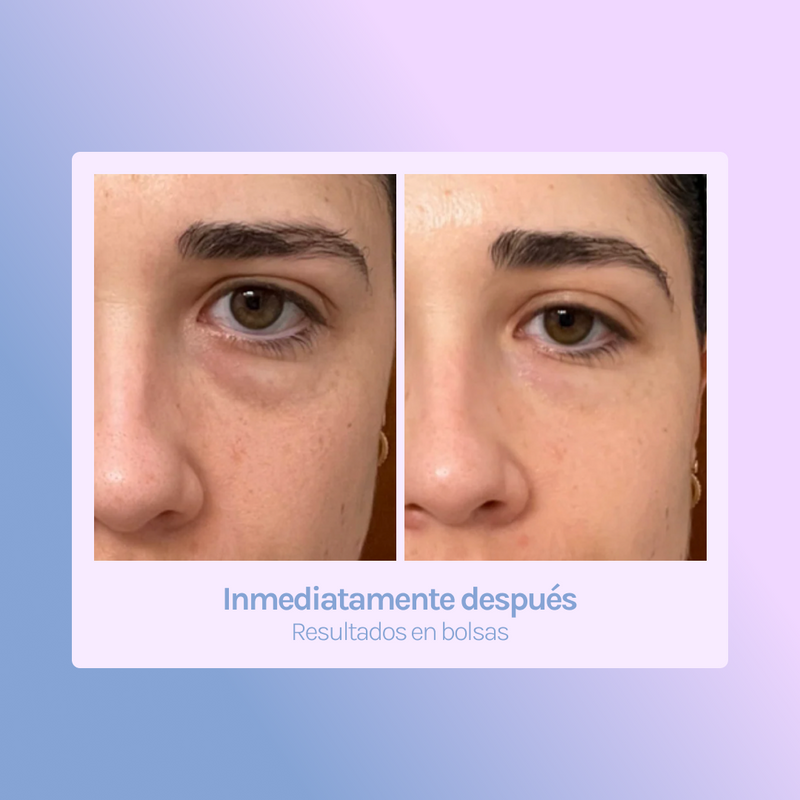 E COMPLEX Contorno de ojos - bolsas + ojeras
