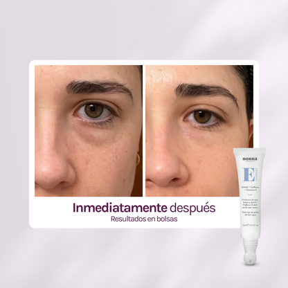 E COMPLEX Contorno de ojos - bolsas + ojeras