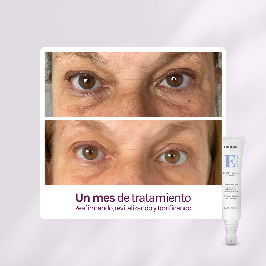 E COMPLEX Contorno de ojos - bolsas + ojeras