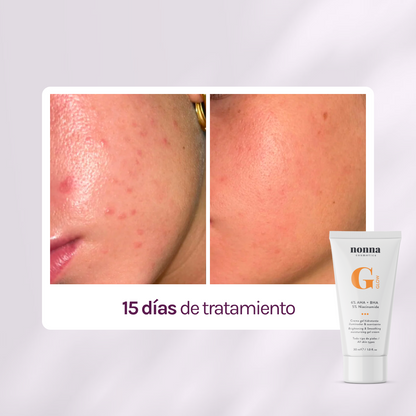 GGLOW Exfoliante - 5% Ácido Glicólico &amp; Niacinamida