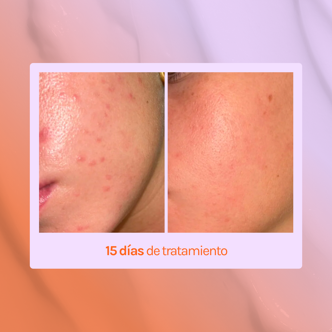 GGLOW Exfoliante - 5% Ácido Glicólico &amp; Niacinamida