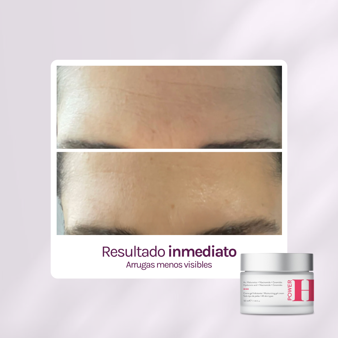POWER H Hidratante c/ Hialurónico, Ceramidas &amp; Niacinamida