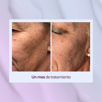 STARTER R - Retinol 0,15% + 5% Niacinamida