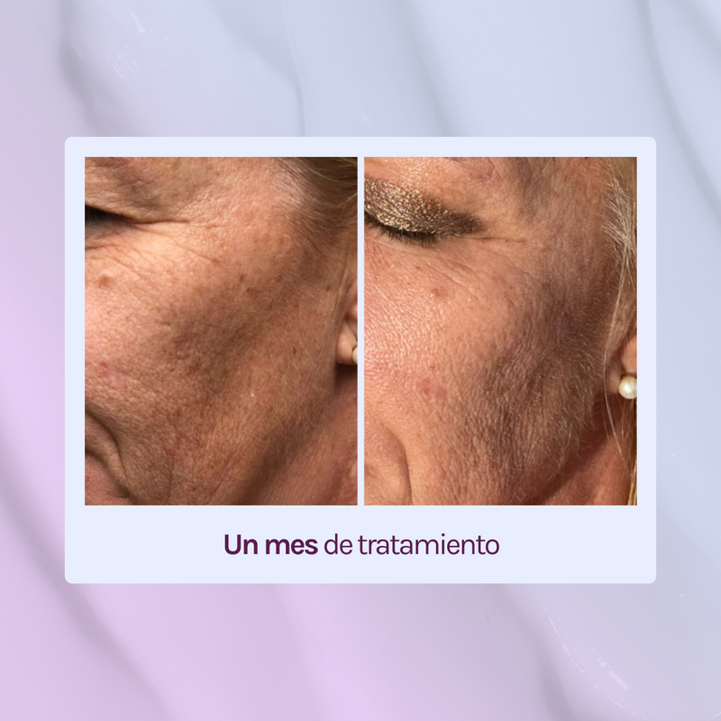 STARTER R - Retinol 0,15% + 5% Niacinamida